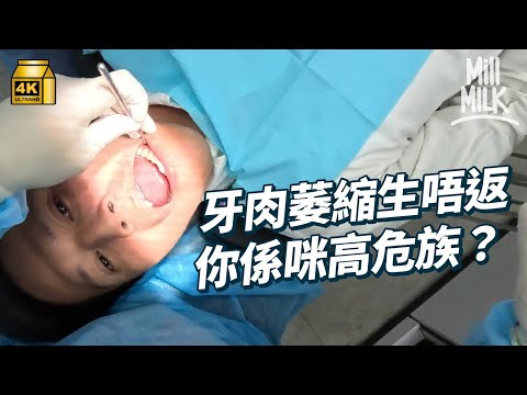 #MM｜初老症狀原來包括牙肉！實測MM同事牙齒牙肉健康 發現有同事有牙肉萎縮問題！刷牙流牙血要小心 可能係牙肉萎縮先兆嚴重會甩牙！｜#Weekly_pedia #4K