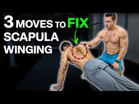 How I Fixed My Winging Scapula