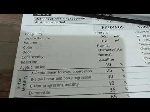 قراءة تحليل السائل المنوى واعرف بنفسك نتيجة التحليل وما تشير الية الارقام