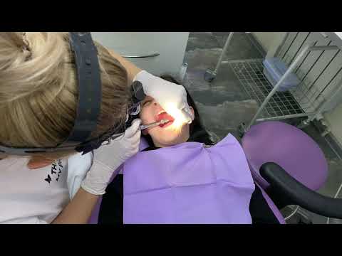 Мандибулярная анестезия у детей