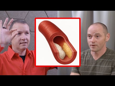 13 minutes of Nerding out on LDL, Atherosclerosis, Vasa Vasorum, and much more -- w/ Stephen Hussey