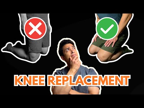 Can you kneel after knee replacement? Wrong question.