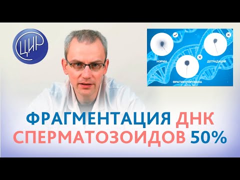 ИКСИ при фрагментации ДНК сперматозоидов 50%. Тестикулярные сперматозоиды.  Андролог Живулько А.Р.