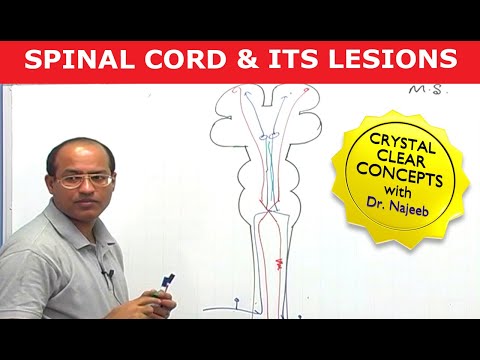 Spinal Cord Injury and its Lesions | Neuroanatomy