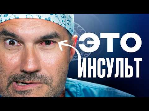 5 ранних признаков инсульта — НЕ упусти их!