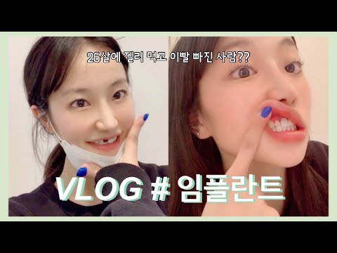 [ 갑자기 분위기 임플란트 ] 젤리 먹다가 이빨 빠진 vlog..