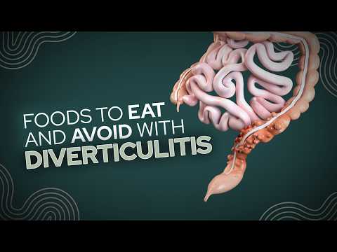 Foods To Eat and Avoid With Diverticulitis