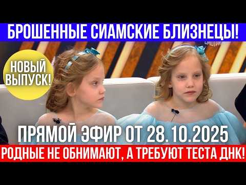 Брошенные сиамские близнецы прошли ДНК-тест, чтобы их признали родственники!