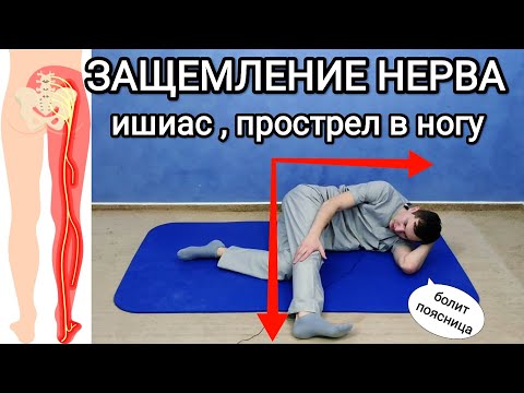 Защемление седалищного нерва. Прострел в ногу, ишиас / Большой комплекс упражнений при боли в спине
