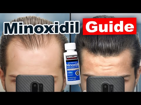 What I Learned in the First 3 Months of Minoxidil (Weekly Results)
