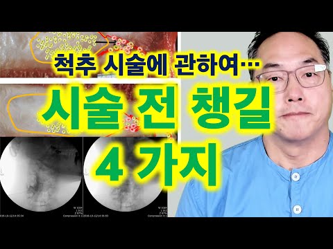 척추 시술에 관하여... 시술 전에 챙길 4 가지