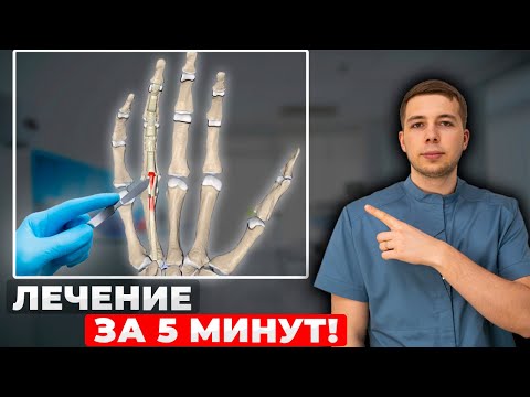 Как ВЫЛЕЧИТЬ щелкающий палец НАВСЕГДА! Полная процедура лечения!
