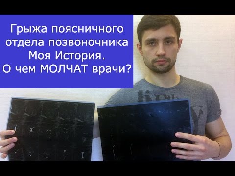 Грыжа поясничного отдела позвоночника. Моя история лечения.