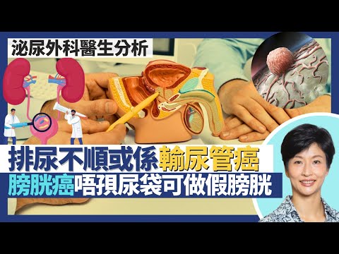 腎盂癌輸尿管癌+膀胱癌（泌尿系統癌症）｜排尿不順無痛楚都可能係腎盂輸尿管腫瘤！輸尿管手術治療要同時切除部分膀胱？膀胱癌術後不想用尿袋可做體內假膀胱？｜王建芳醫生 泌尿外科醫生徐學良醫生｜人類健康研究所