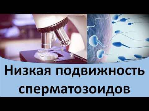 Низкая подвижность сперматозоидов