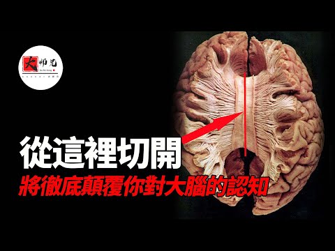 你大腦中有無數個你在爭奪你身體的控制權！你的大腦一直在欺騙你，你卻從來沒有懷疑它，甚至還100%的相信！裂腦手術，胼胝體切除術|seeker大师兄