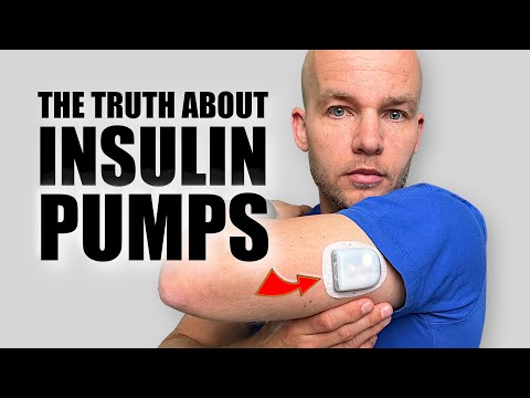 Watch This Before You Get an Insulin Pump
