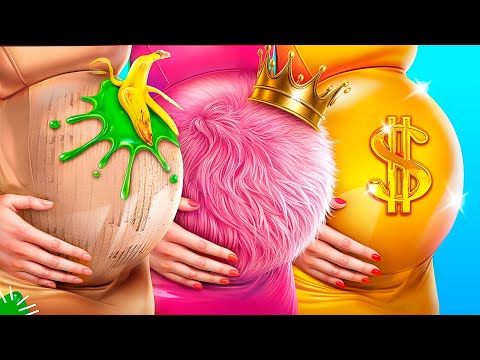 Rijk vs Arm vs Mega-Rijk Zwanger in het Ziekenhuis! Wie wordt Verliefd op de Dokter?