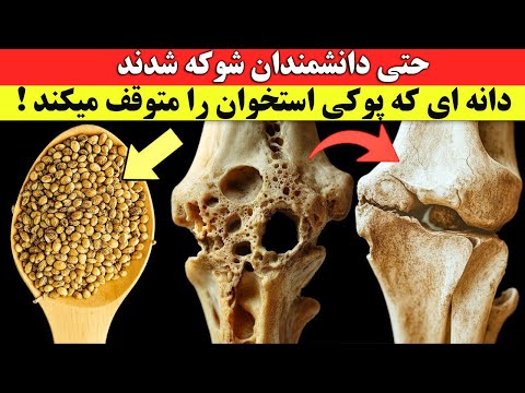 حتی دانشمندان شوکه شده اند !‌ دانه ای که پوکی استخوان را متوقف می کند