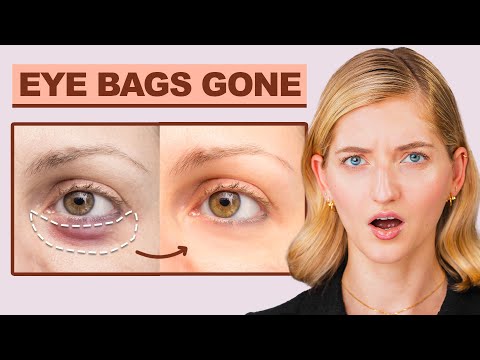 I'm Shocked! This ONE Acupressure Point Makes Eye Bags Disappear (Try It Now!)