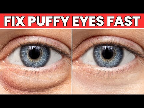 Puffy Eyes? One Kitchen Ingredient Fixes It Fast