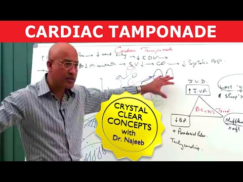 Cardiac Tamponade | Causes Symptoms and Treatment🫀