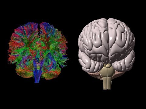 Diffusion Tensor Imaging (DTI)
