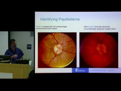 CSF presents "Idiopathic Intracranial Hypertension (IIH): Advances in Treatment" - Dr. Imran Chaudry