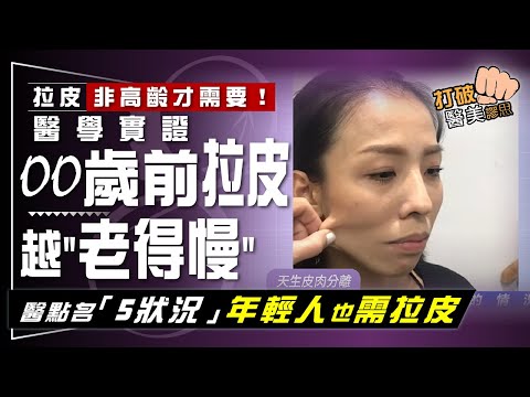 越年輕拉皮  越「老得慢」？　醫學實證OO歲前動拉皮手術  效果更持久  醫點名：年輕人有「這些狀況」該考慮拉皮 打破醫美謬思 317-20240614