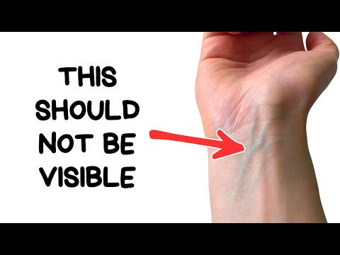 If You Can See Your Wrist Veins, This Explains Your Skin