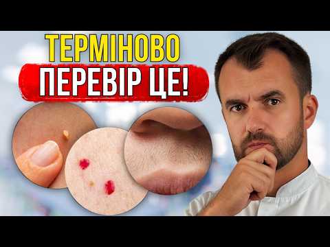 THIS IS HOW DIABETES BEGINS! Early symptoms you don't notice!