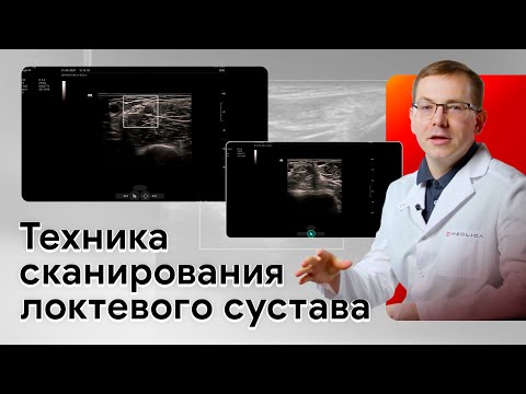 Техника проведения УЗИ локтевого сустава на Mindray Imagyn i9