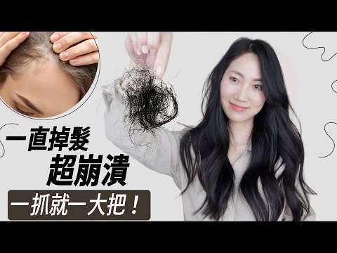 做對了可救回來！請耐心再讓頭髮長出來@DrGrace