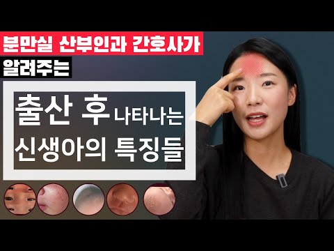 신생아 특징 ㅣ 가성사시, 시력, 콘헤드, 두혈종, 생식기, 가슴, 신생아 피부, 몸무게 ㅣ 출산 후 우리아기 모습은?