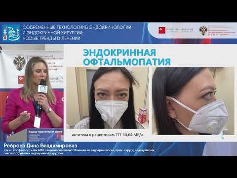 Conservative treatment of endocrine ophthalmopathy