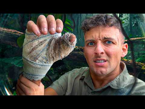 Ce tournage a mal tourné. Amputation !?