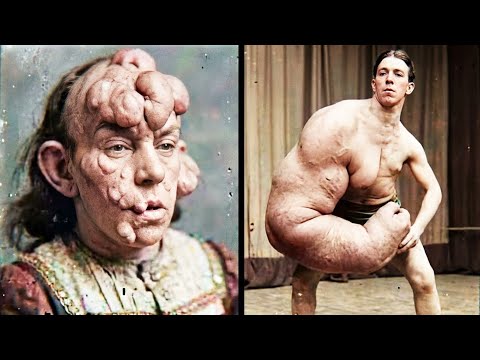 15 Circus Freaks That Actually Existed (2025)