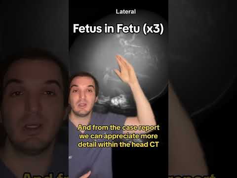 #medtok #meded #medicaleducation #tiktokdoc #radiology #radiologist #medicine #doctor #emergency