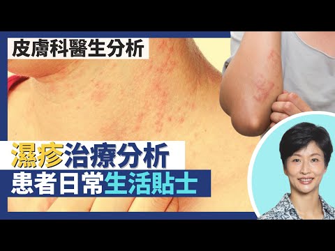 濕疹｜濕疹治療分析拆解類固醇迷思 非類固醇濕疹藥膏非人人適合！生活貼士預防復發 洗澡不用番梘／沐浴露？保濕潤膚膏如何選擇？｜王建芳醫生 皮膚科何景文醫生｜人類健康研究所
