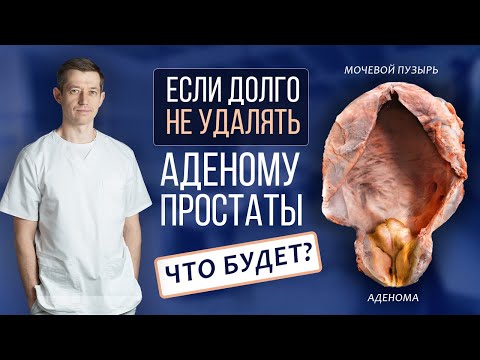 Осложнения и последствия аденомы простаты