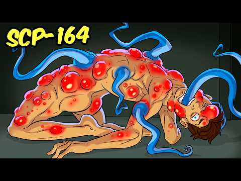 SQUID TUMORS - SCP-164