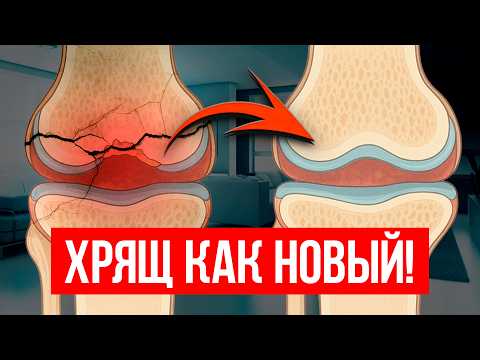 ХРЯЩ ВОССТАНАВЛИВАЕТСЯ! Методы, которые запускают регенерацию БЕЗ ОПЕРАЦИИ!