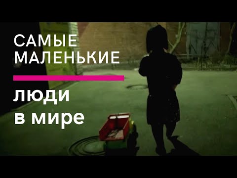 Самые маленькие люди в мире. Ахондроплазия