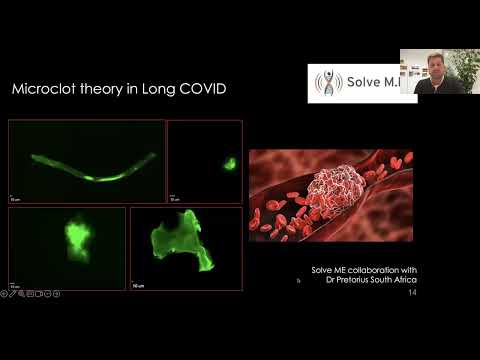 Skeletal Muscle Fatigue & Post-Exertional Malaise in People w/Long Covid & Implications for ME/CFS