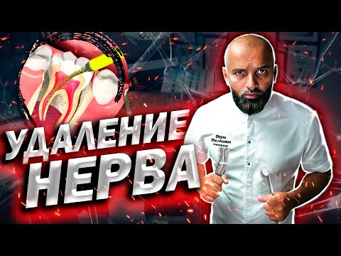 УДАЛЕНИЕ ЗУБНОГО НЕРВА! БОЛЬНО ИЛИ НЕТ?