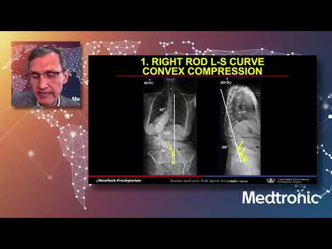 Lecture: Rod Application and Correction Maneuvers