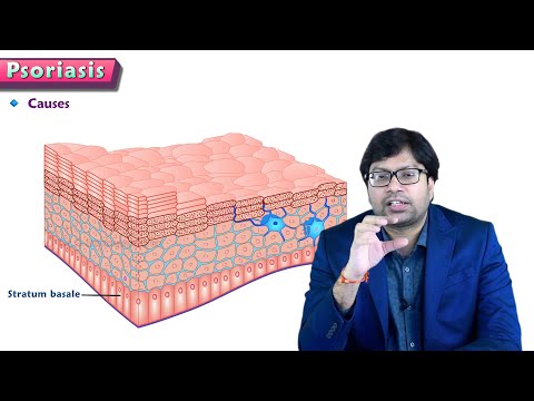 Psoriasis : Causes, Types, Diagnosis and Treatment ( Clinical essentials ) - Dr Sandeep Golla MD