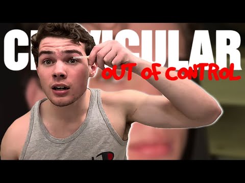 Clavicular Is Out Of Control