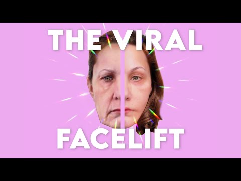 Michelle Wood’s Viral Facelift and Why I Chose Dra Maribel Belmontes in Guadalajara at 48 Years Old