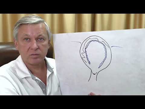 Отношения мужчины и женщины Психосоматика кисты, молочницы, эндометриоза. Психолог Азаров